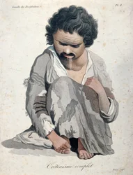 Totaalinen kretinismi, Baron Jean Louis Alibertin (1768-1837) kirjasta